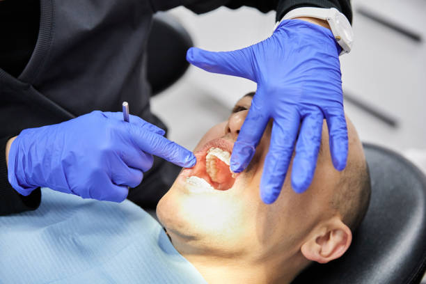 Best Emergency Denture Repair in Strathmore, CA